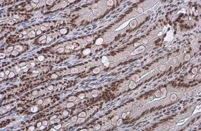 Immunohistochemistry-Paraffin: c-jun [p Ser73] Antibody [NBP3-13304]